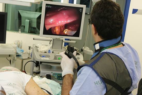 Realização do exame de endoscopia