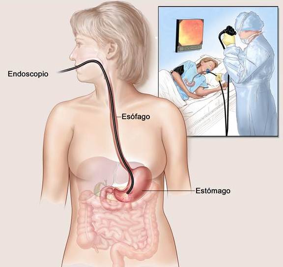 Procedimento da endoscopia